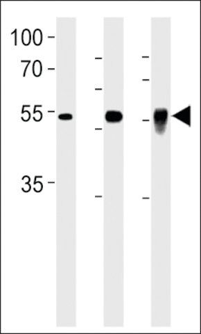 ANTI-DMRTA2(C-TERMINAL) antibody produced in rabbit