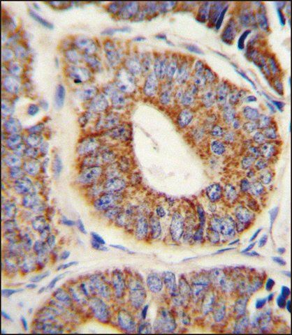 ANTI-DNAJA1 (CENTER) antibody produced in rabbit