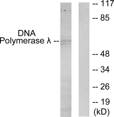 Anti-DNA Polymerase  antibody produced in rabbit