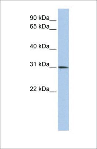 Anti-DLX1 antibody produced in rabbit