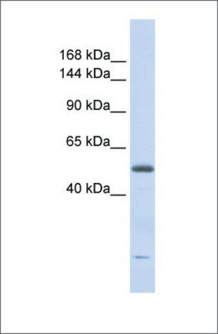 Anti-DNA2L antibody produced in rabbit