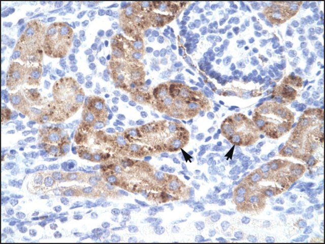 Anti-DMRTA2 antibody produced in rabbit