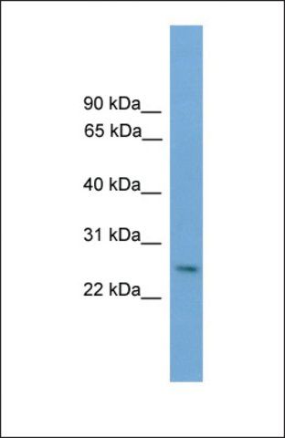 Anti-DLX4 antibody produced in rabbit