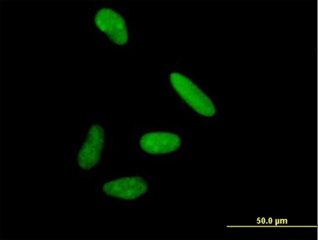 Anti-DIS3 antibody produced in mouse