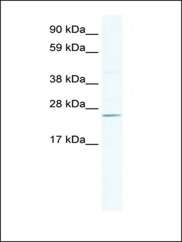 Anti-DNAJC17 antibody produced in rabbit