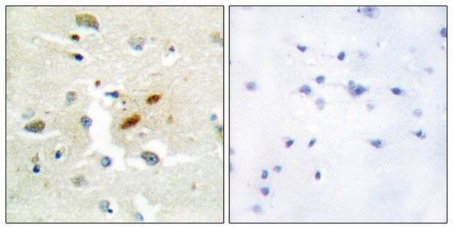 Anti-DNA Polymerase , N-Terminal antibody produced in rabbit