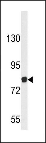 ANTI-EVI5 (CENTER) antibody produced in rabbit