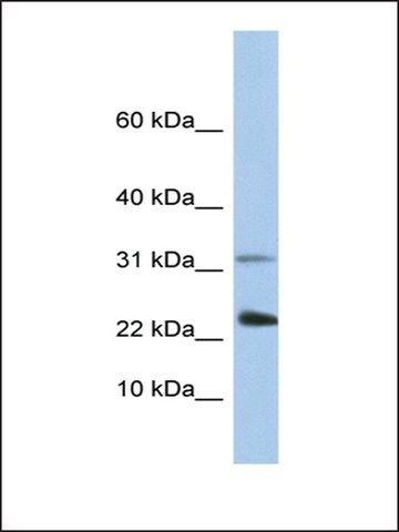 Anti-EXOSC3 antibody produced in rabbit