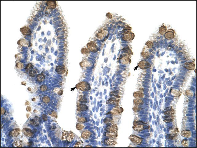 Anti-EXOSC3 (AB1) antibody produced in rabbit