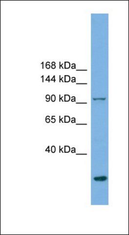 Anti-EXOC1 antibody produced in rabbit