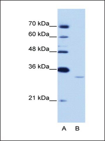 Anti-EXOSC6 (AB1) antibody produced in rabbit