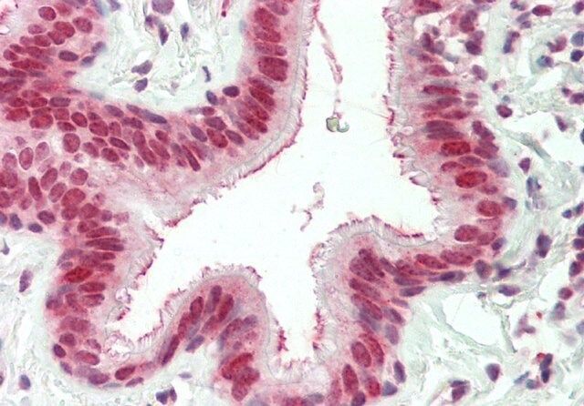 Anti-EXOSC10 antibody produced in rabbit