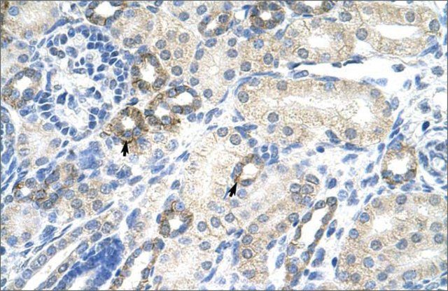 Anti-EZH2 antibody produced in rabbit