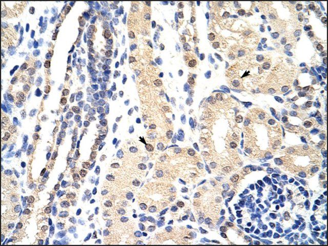 Anti-EXOSC3 antibody produced in rabbit