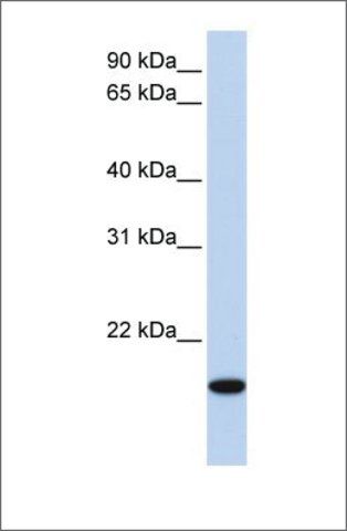 Anti-EVX2 (ab1) antibody produced in rabbit