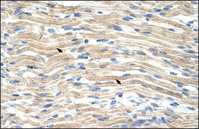 Anti-EXOSC6 (AB2) antibody produced in rabbit