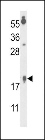 ANTI-FA96B(N-TERMINAL) antibody produced in rabbit