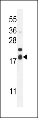 ANTI-F162A (C-TERM) antibody produced in rabbit