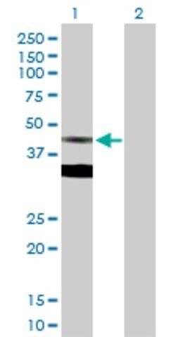 Anti-FDPS antibody produced in rabbit