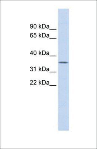 Anti-FCN1 antibody produced in rabbit