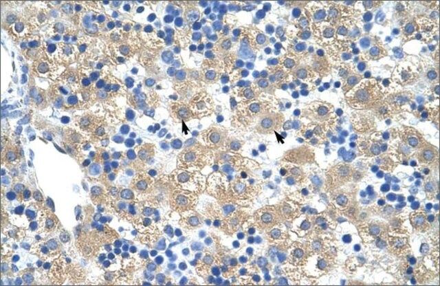 Anti-FERD3L antibody produced in rabbit