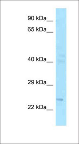 Anti-FGF20 antibody produced in rabbit