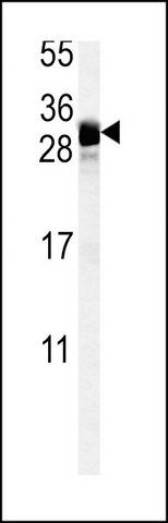 ANTI-FGF7 (CENTER) antibody produced in rabbit