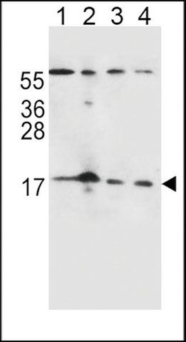 ANTI-FGF22 (N-TERM) antibody produced in rabbit