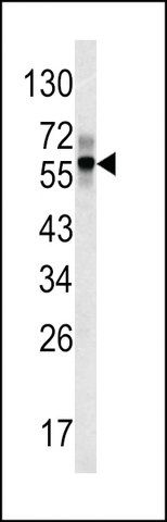 ANTI-FIBB(C-TERMINAL) antibody produced in rabbit