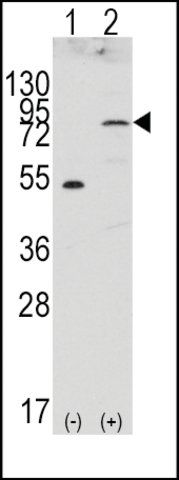 Anti-FGFR4 antibody produced in rabbit