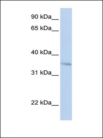 Anti-FHL3 antibody produced in rabbit