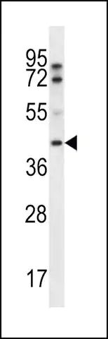 ANTI-FIBP (CENTER) antibody produced in rabbit