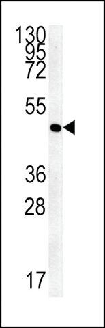 ANTI-FLJ11506(C-TERMINAL) antibody produced in rabbit