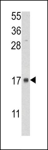 ANTI-FKBP2(N-TERMINAL) antibody produced in rabbit