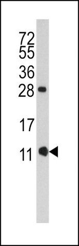 ANTI-FKBP1B (N-TERM E6) antibody produced in rabbit