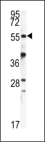 ANTI-FKBP9(N-TERMINAL) antibody produced in rabbit