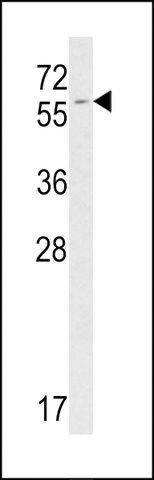 ANTI-FKBP9(C-TERMINAL) antibody produced in rabbit