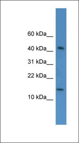 Anti-FLJ10490 antibody produced in rabbit