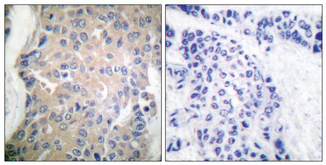 Anti-CPI17  antibody produced in rabbit