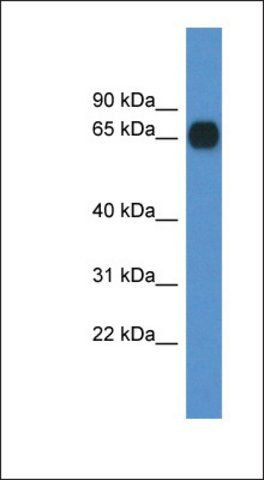 Anti-CPNE6 antibody produced in rabbit