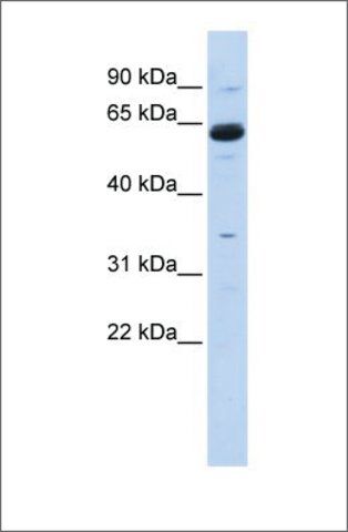 Anti-CPNE1 antibody produced in rabbit