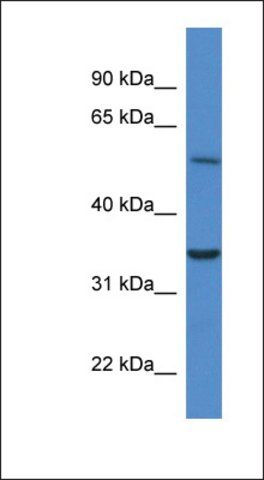 Anti-CYB5R4 antibody produced in rabbit