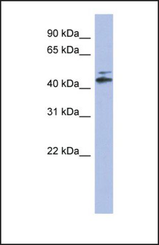 Anti-CYP20A1, (N-terminal) antibody produced in rabbit