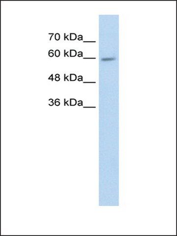 Anti-CYP4F11 antibody produced in rabbit