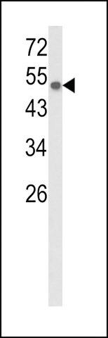 ANTI-CYP8A1(C-TERMINAL) antibody produced in rabbit