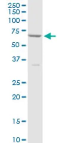 Anti-CYP4V2 antibody produced in mouse