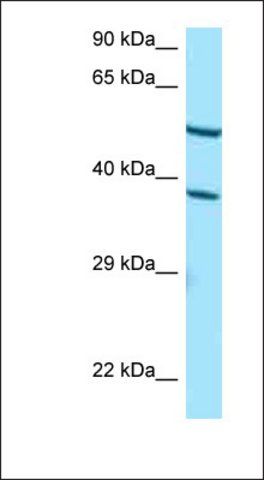 Anti-CYP4F2 antibody produced in rabbit