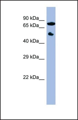 Anti-CYP11B2