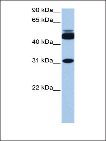 Anti-CYLC2 antibody produced in rabbit