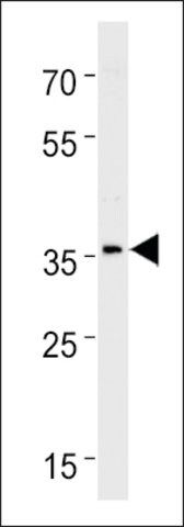 ANTI-DANRE HOXC13A(C-TERMINAL) antibody produced in rabbit